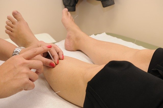 Weakness, Numbness, and Pain: Acupuncture for Neuropathy